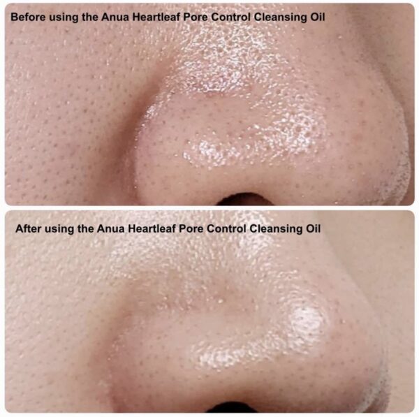 Anua - Hearleaf Pore Control Cleansing Oil - Imagen 3
