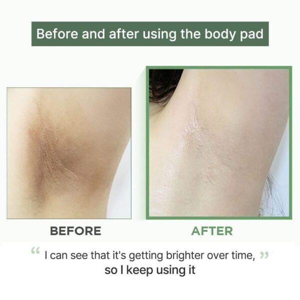 Celimax - One Step Body Brightening Pad 60ea - Imagen 4